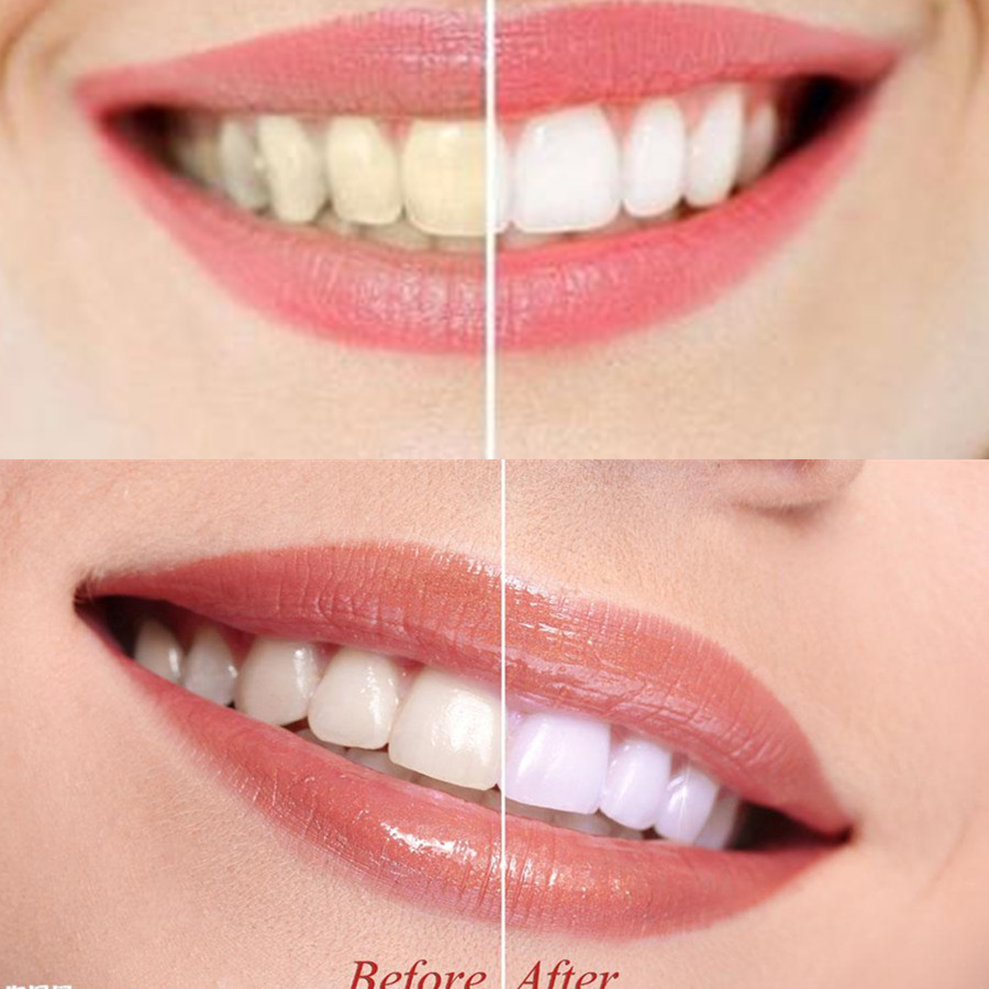 Bamboo Charcoal Teeth Tooth De - Teeth Whitening Charcoal 评论和价格