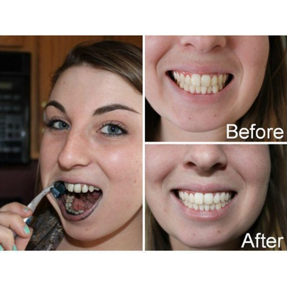 Bamboo Charcoal Teeth Tooth De - Teeth Whitening Charcoal 评论和价格