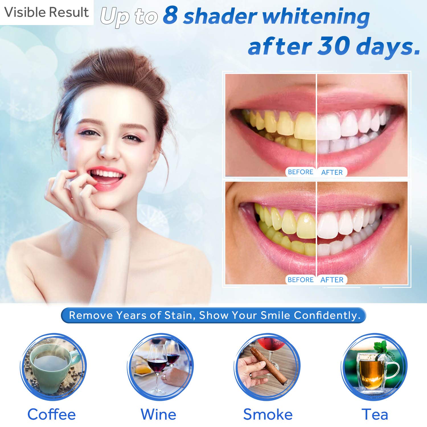 Teeth Whitening Gel Refill Syr - Teeth Whitening Price 评论和价格