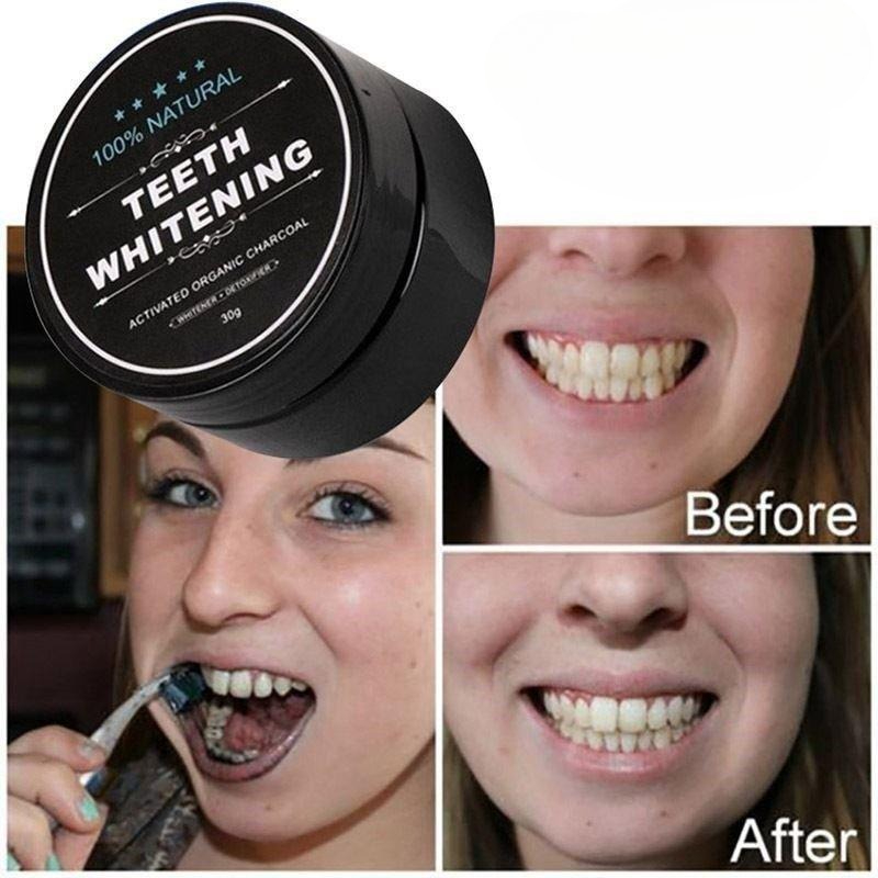 1 Box Activated Charcoal Teeth - Teeth Whitening Charcoal 评论和价格