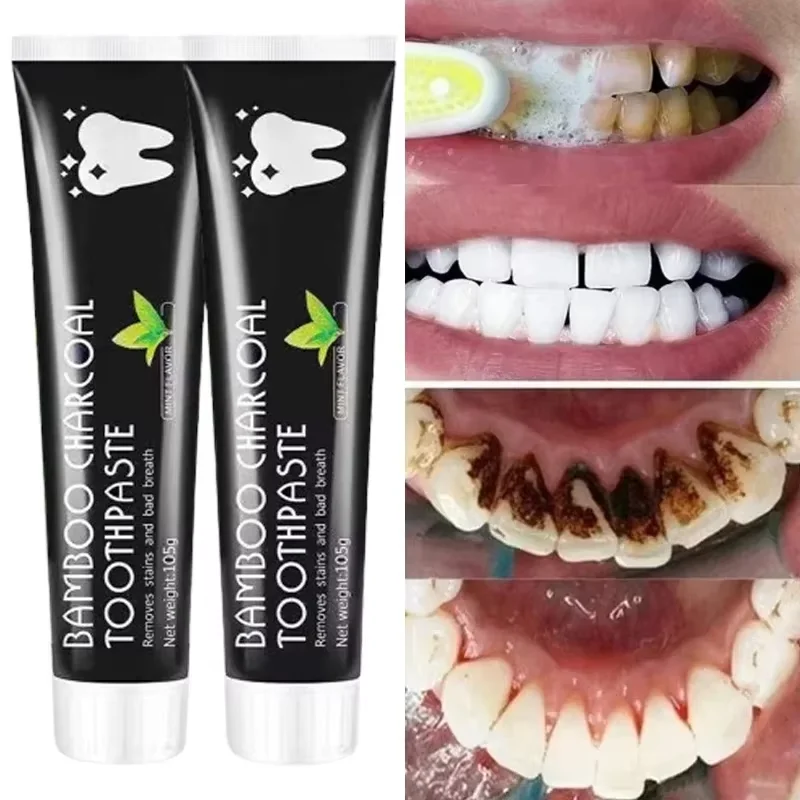 Whitening Toothpaste Bamboo Ch - Teeth Whitening Charcoal 评论和价格